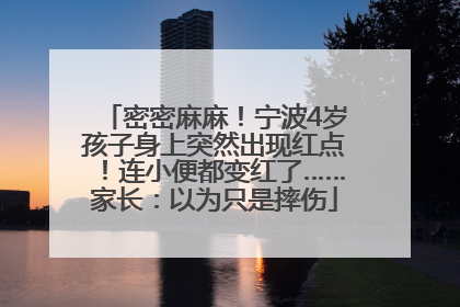 密密麻麻！宁波4岁孩子身上突然出现红点！连小便都变红了……家长：以为只是摔伤